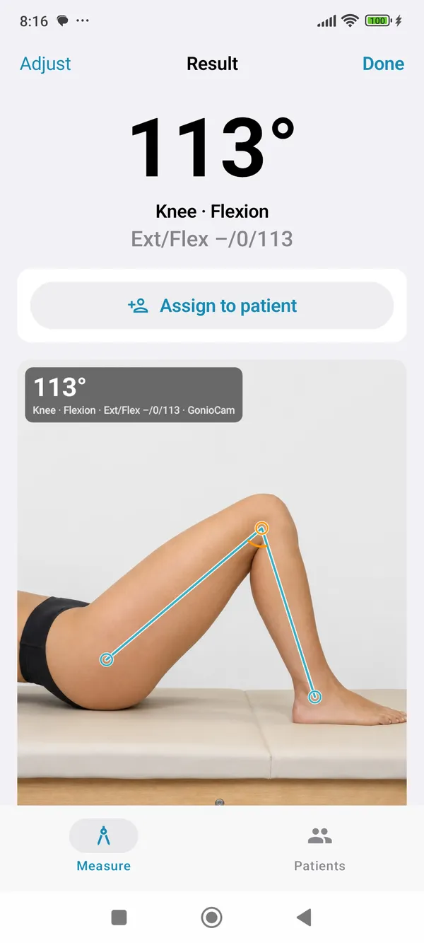 GonioCam for Android: result showing a 113° knee angle in neutral zero notation
