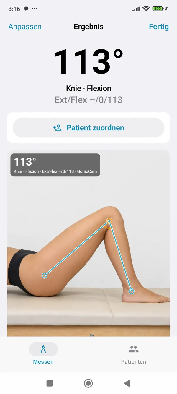 GonioCam für Android: Ergebnis mit Kniewinkel 113° und Neutral-Null-Notation
